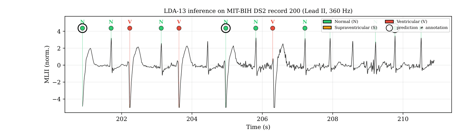 A ten-second strip of MIT-BIH record 200 with each detected beat marked and labelled N or V by the deployed LDA code; two beats whose prediction disagrees with the reference annotation are ringed.
