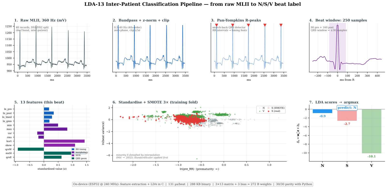 The LDA-13 pipeline in seven panels: raw MLII signal, bandpass and normalisation, Pan-Tompkins R-peak detection, the 250-sample beat window, the 13 standardised features, SMOTE on the training fold, and the three discriminant scores with the argmax prediction.